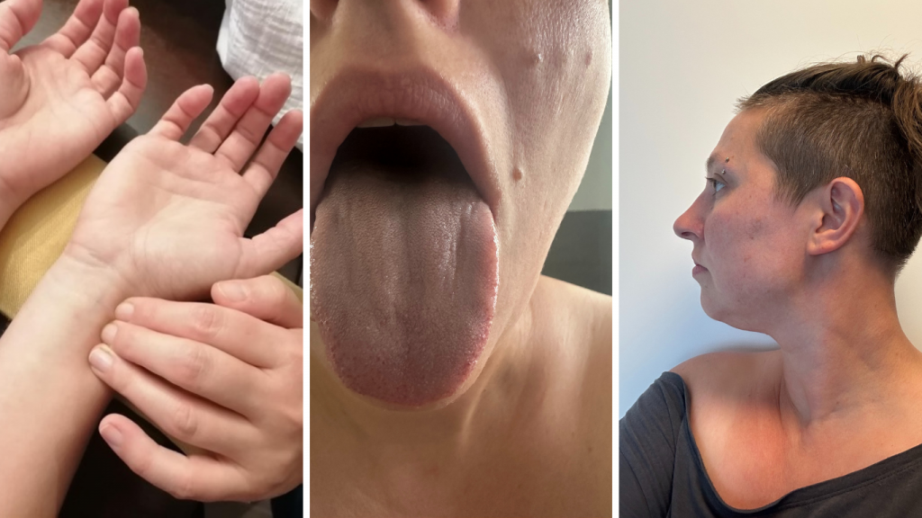 3 Fotos von Veronika Taig: beim Pulstasten, ihre herausgestreckte Zunge, ihre Gesicht von der Seite